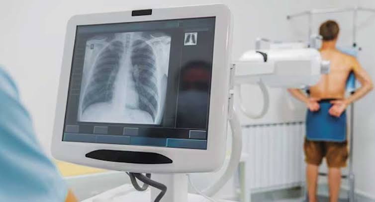 Modernising X-Ray Imaging with Digital Radiography Solutions